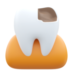Dental Trauma Management